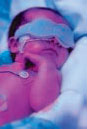 NICU